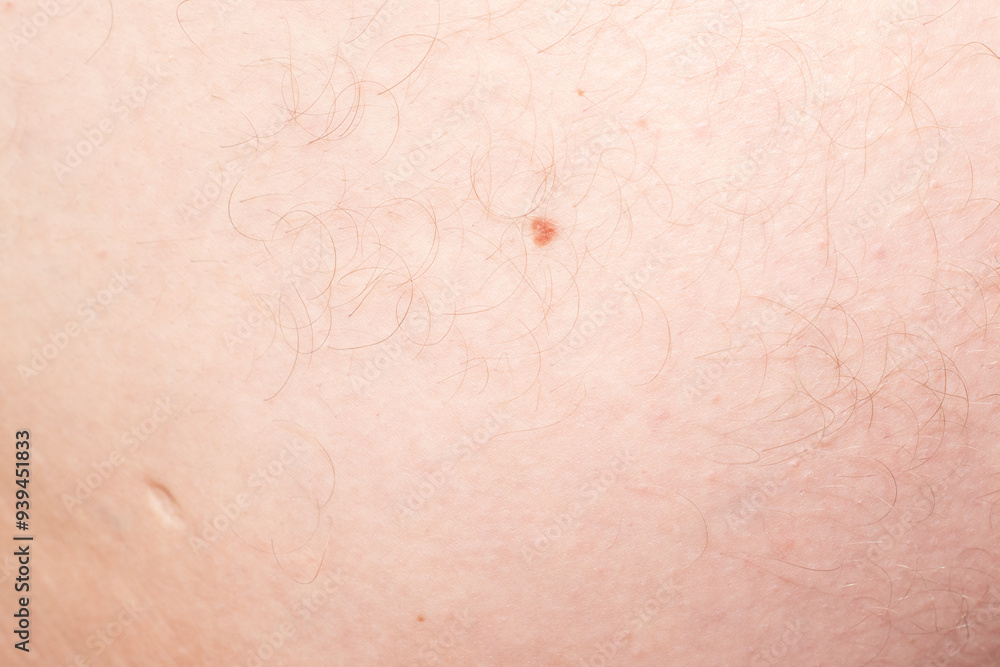 Fototapeta premium A close-up of skin with small moles, perfect for dermatology, skincare, or medical-themed projects.
