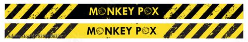 MONKEY POX sign	