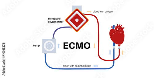 Extracorporeal membrane oxygenation