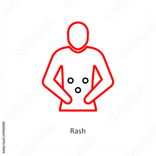 Rash