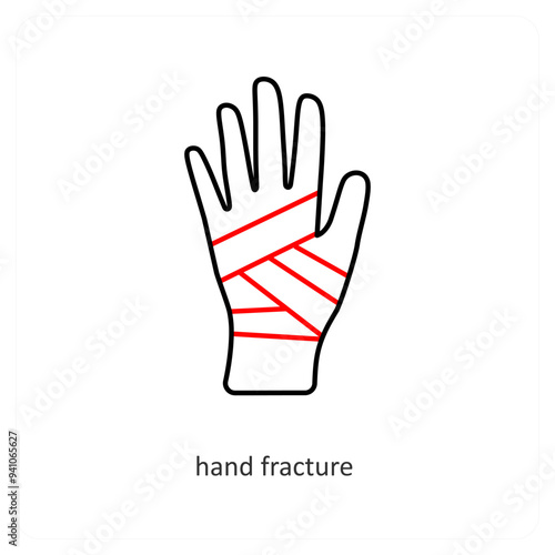 Hand Fractutre