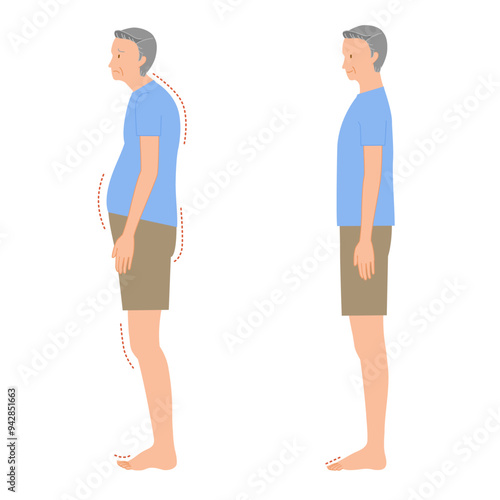 シニアの足の浮き指と正常な足裏のイラストセット（男性の全身の姿勢の崩れ）