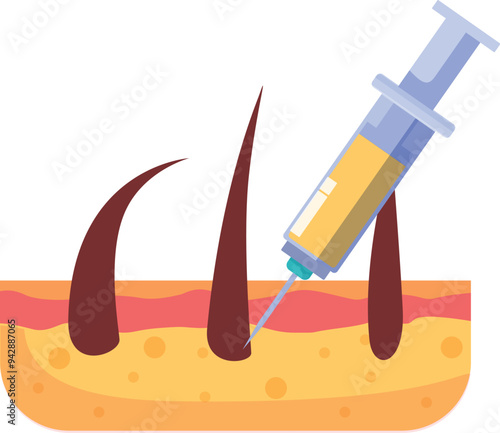 Illustration of a syringe injecting serum into skin for hair growth treatment