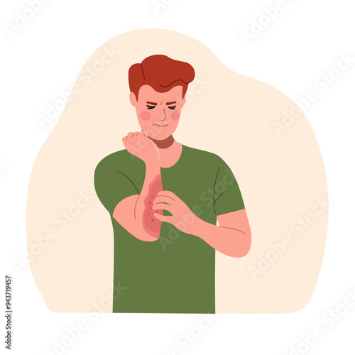 Young suffering man scratching the skin on his hand isolated. Allergy concept. Vector flat style cartoon illustration