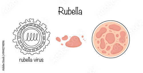 Rubella