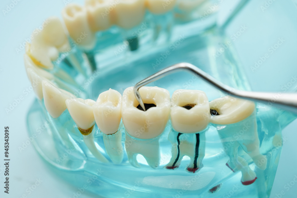 Teeth dental model with tool for dentist use to cleaning care treatment. Teeth dental model with tool for dentist use to cleaning care treatment.