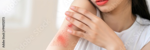 Asian young woman scratches itchy arm with hand, red rash or skin irritation from insect bites, allergy reaction on her body. Dermatology treatment for eczema, dermatitis, skin care, health concern.