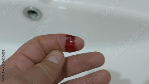 Blood flows into the sink from the hand of a person whose hand was injured with a knife.