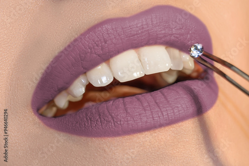 Dentist choosing gemstone or rhinestones for patient's teeth, Close-up mouth with beautiful lipstick