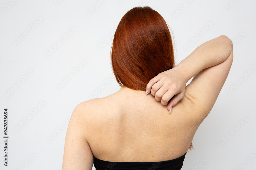 Young woman scratching itchy back skin problem Young woman scratching itchy back skin problem