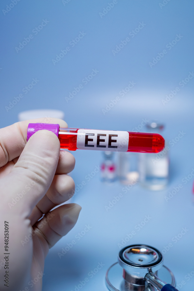 Fototapeta premium Eastern Equine Encephalitis (EEE) is an extremely rare but serious and often fatal infection that causes encephalitis or inflammation of the brain