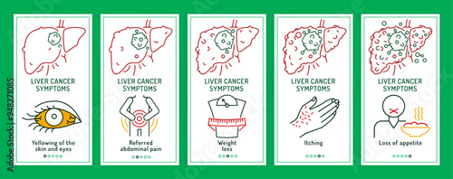 Liver cancer symptoms. Oncology, hepatology concept. Editable vector illustration