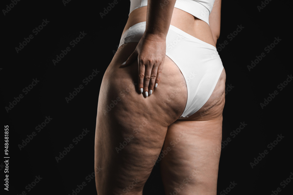 Naklejka premium Woman with cellulite on black background, closeup