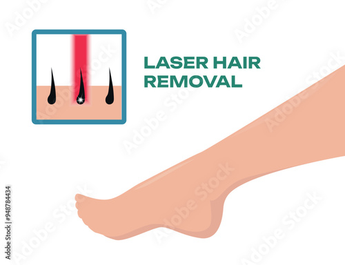 Smooth beautiful woman leg. Beauty salon poster and laser hair removal. Female legs.