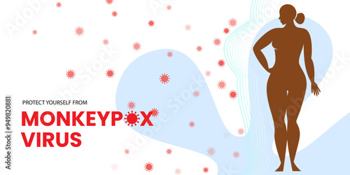 Woman suffering mpox virus. Monkeypox virus. New orthopox virus.