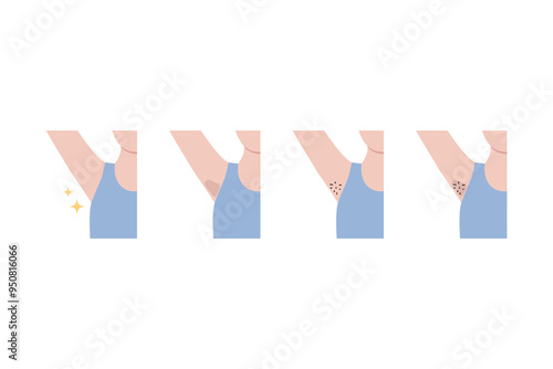 Clean and hairy dark problem underarm armpit icon set. Before and after. Hair remove, beauty, laser treatment, waxing, body care concepts. Flat vector design isolated on white background illustration.
