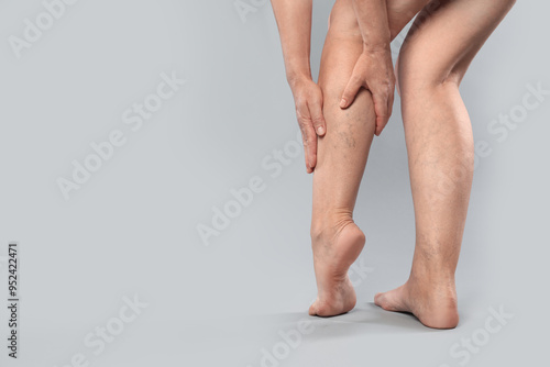 Woman suffering from varicose veins on grey background, closeup. Space for text photo