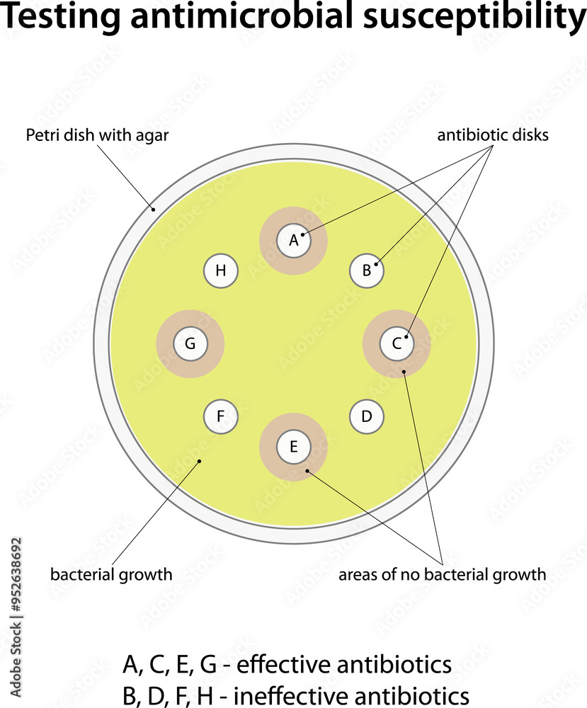 Testing antimicrobial susceptibility (disk diffusion test) Testing antimicrobial susceptibility (disk diffusion test)