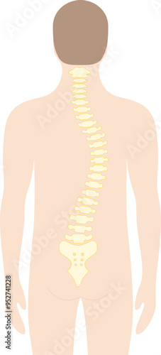 Scoliosis vector flat illustration stock illustration
