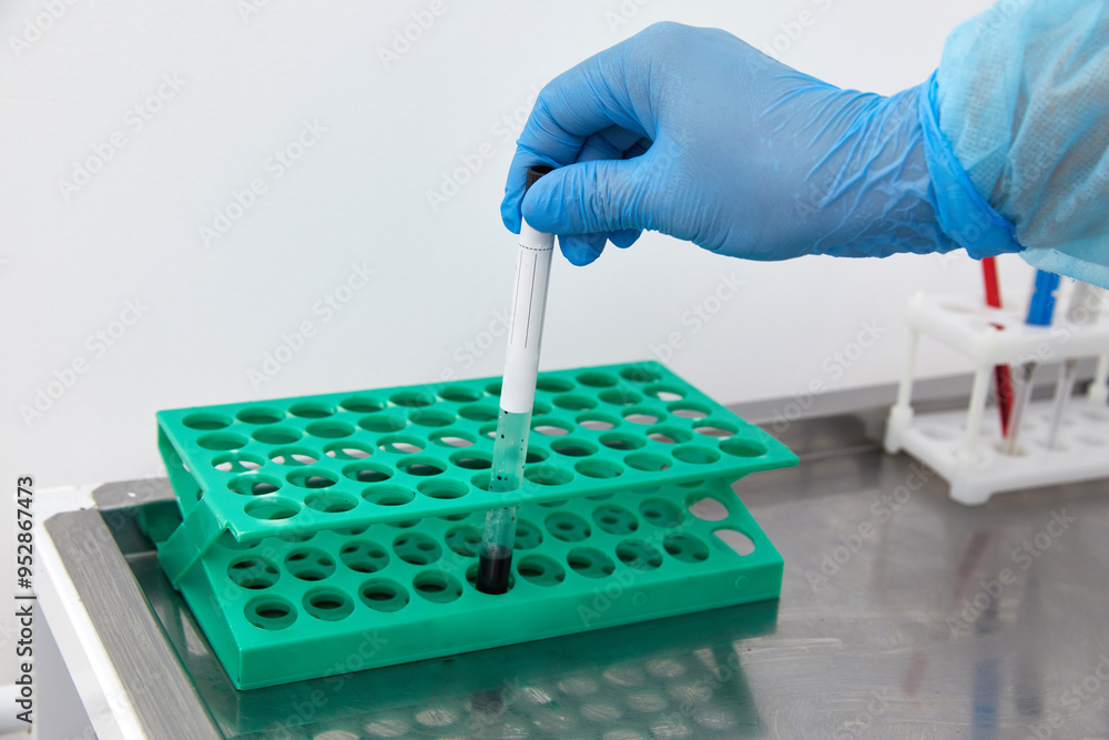 Scientist working with blood sample in laboratory Scientist working with blood sample in laboratory