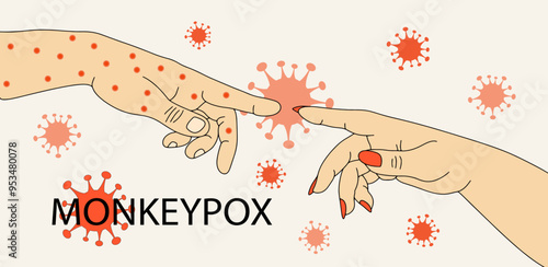 Illustration of monkeypox virus transmission.The hand of an infected person touches the hand of a healthy person.