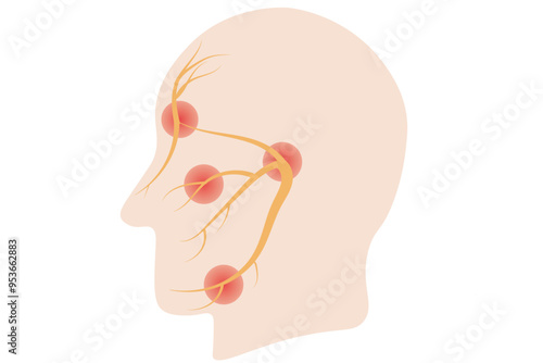 Trigeminal neuralgia,facial pain due to trigeminal nerve irritation. ,multiple sclerosis, cluster headaches, postherpetic neuralgia, and temporomandibular joint disorder,face 