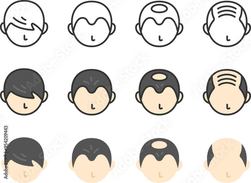 薄毛の男性のアイコンのイラストセット