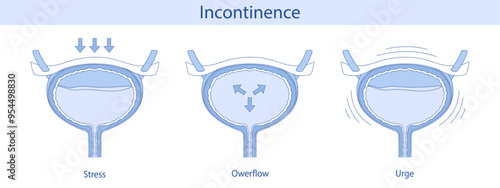 Anatomy of the bladder. Diagram of types of urinary incontinence. Vector illustration hand drawn.