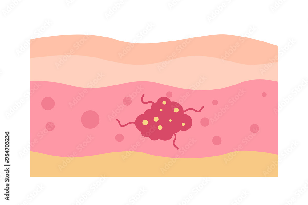 cancer tumor cell disease concept cancer tumor cell disease concept