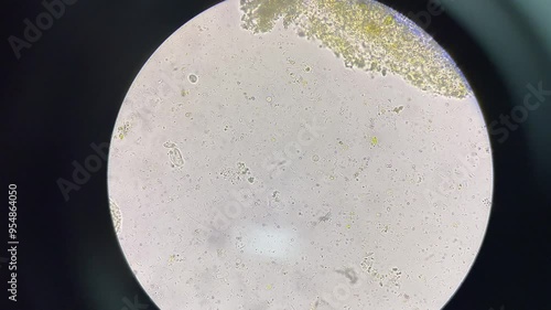Trichomonas moving.