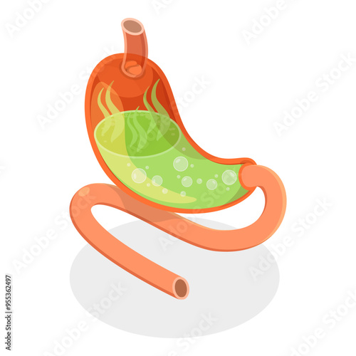 3D Isometric Flat Vector Set of Stomach Problems, Digestive System Issues. Item 4