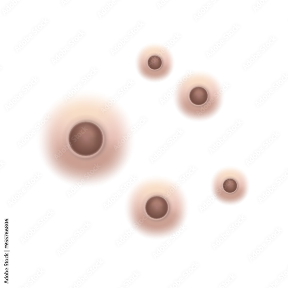 Blackheads acne skin pimple, vector illustration Blackheads acne skin pimple, vector illustration