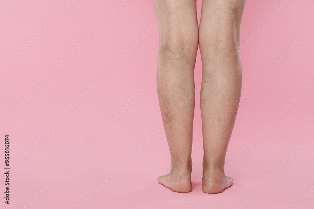 Woman with varicose veins on pink background, closeup. Space for text