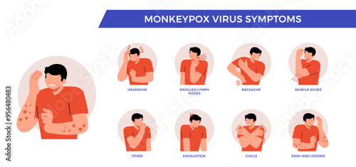 Symptoms of monkeypox virus. Monkeypox Mpox disease with maculopapular rash symptom. Information poster. Infographic with character and icon people