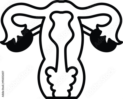 The image is a cartoon of a woman's reproductive system