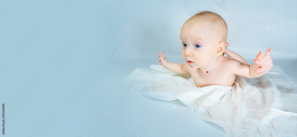 a baby with a hemangioma on his neck lies on a blue background. banner with a copy space. spread arms, the concept of flight