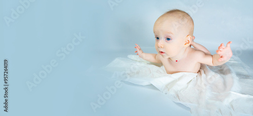 Obraz na płótnie a baby with a hemangioma on his neck lies on a blue background. banner with a copy space. spread arms, the concept of flight w salonie