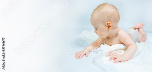 Obraz na płótnie a baby with a hemangioma on his neck lies on a white background. banner with a copy space. profile of a little bald baby girl. the kid looks to the side w salonie