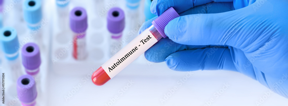 Naklejka premium Doctor holding a test blood sample tube with Autoimmune test on the background of medical test tubes with analyzes.