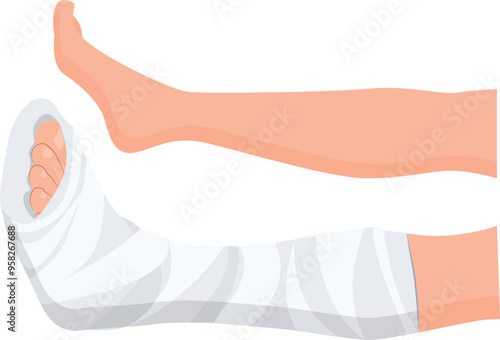 Broken leg Ankle and foot Bandages on the legs