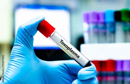 Blood sample tube for toxoplasma test analysis. photo