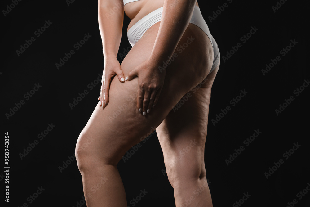 Naklejka premium Woman with cellulite on black background, closeup