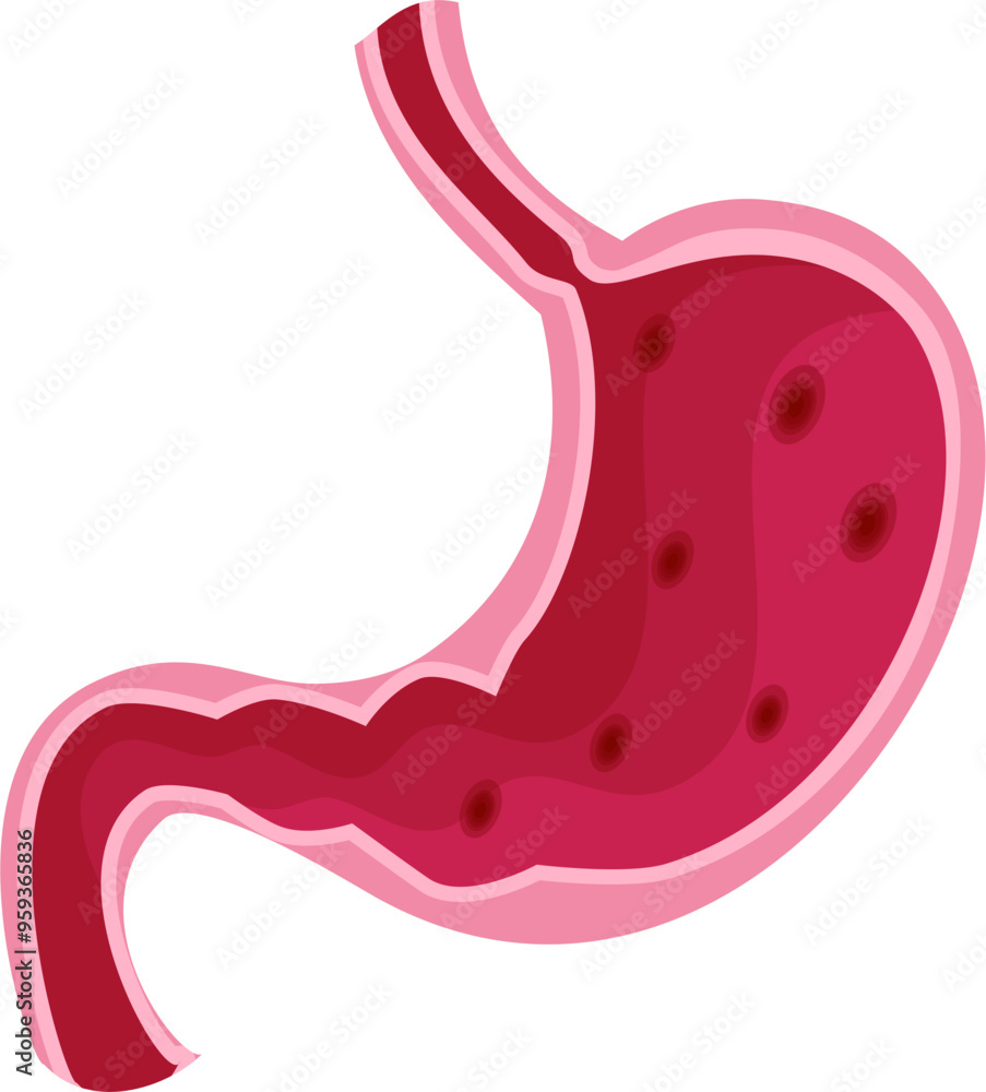 Stomach disease Illustration. Gastroenteritis Stomach disease Illustration. Gastroenteritis
