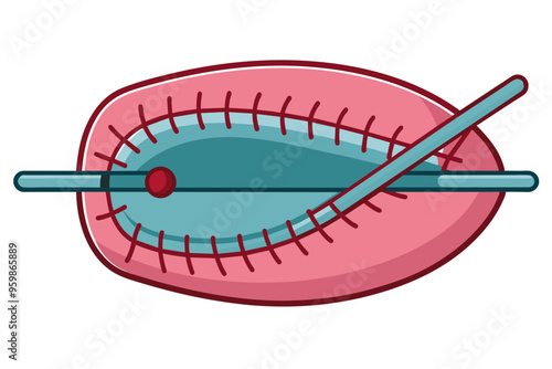  Medical equipment surgical suture vector art illustration  photo