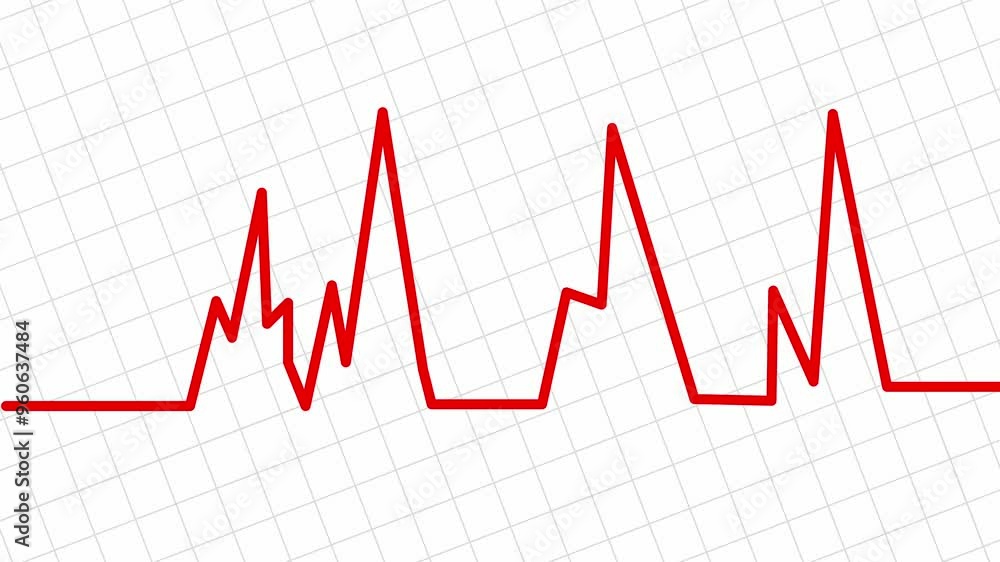 Red color heartbeat motion graphic animation on a white grid line animated background Red color heartbeat motion graphic animation on a white grid line animated background