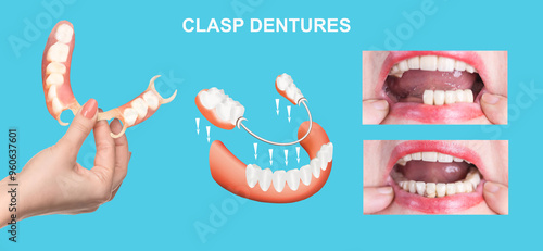 Obraz na płótnie flexible nylon denture on female hand. Removable dentures flexible, devoid of nylon, hypoallergenic exempt from monomer w salonie