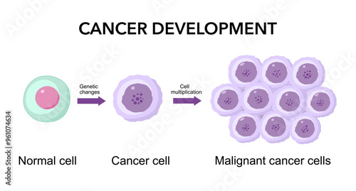 Cancer development. Normal cells are transformed into cancer. Carcinogenesis from Genetic mutations in healthy cell to Malignant cancer cells.