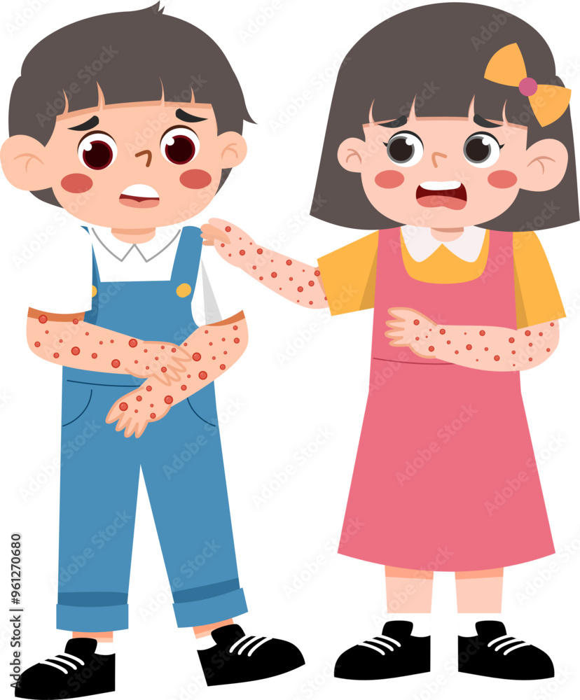 Kid Having Monkeypox Virus Kid Having Monkeypox Virus