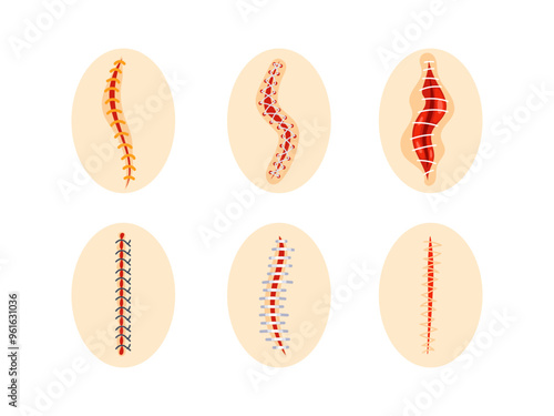 Collection of round icons representing various sutured wounds in different configurations, showing the process of surgical suture healing.