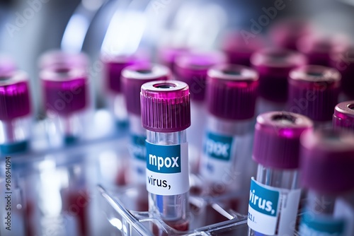 A close-up view of vials in a lab, labeled 'Mpox Virus', with a purple cap.